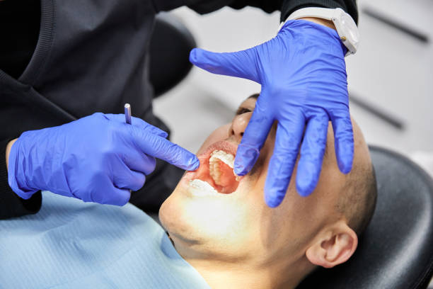Best Dentist for Tooth Abscess  in Saginaw, MI